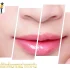 10 อันดับคลินิกรักษาผิวหน้าด้วย Pico Laser ที่ได้รับความนิยมในขณะนี้ 2026